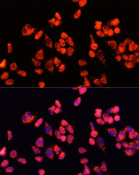 Anti-ANGPT2 Antibody (CAB0698)