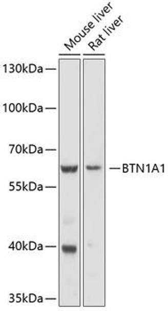 Anti-BTN1A1 Antibody (CAB10107)