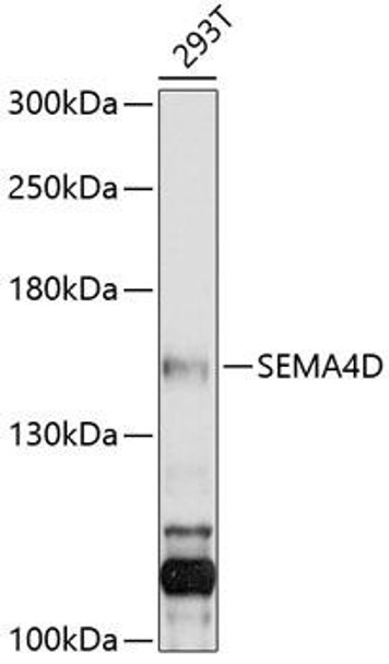 Anti-SEMA4D Antibody (CAB10136)