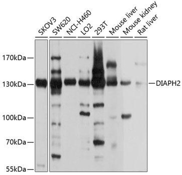 Anti-DIAPH2 Antibody (CAB10209)