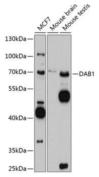 Anti-DAB1 Antibody (CAB10349)
