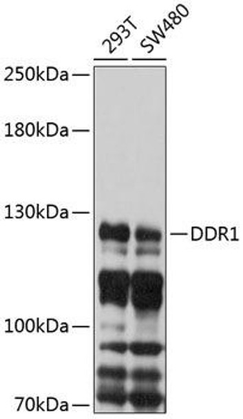 Anti-DDR1 Antibody (CAB10487)