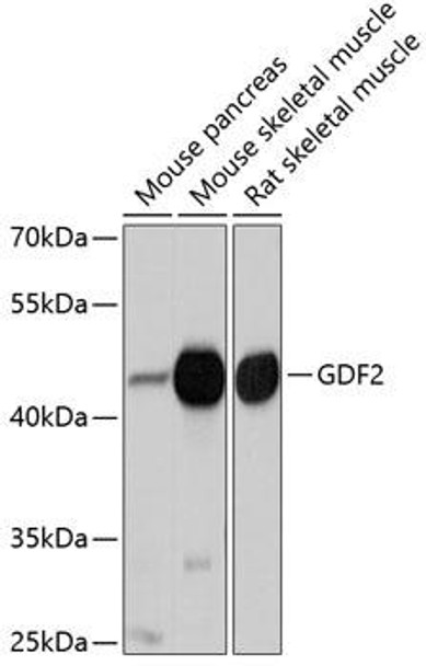 Anti-GDF2 Antibody (CAB10537)