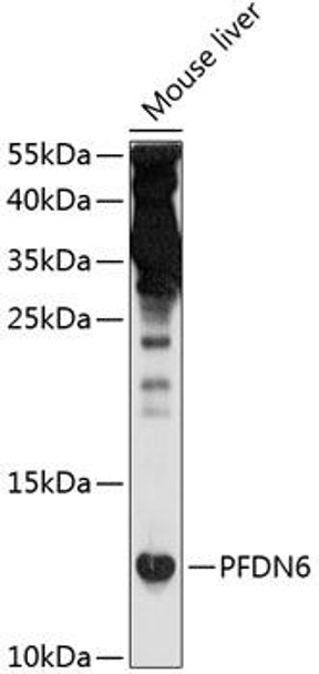 Anti-PFDN6 Antibody (CAB10580)