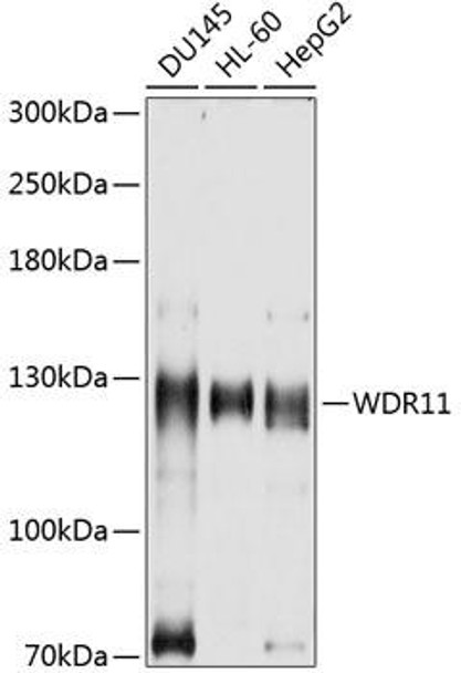 Anti-WDR11 Antibody (CAB10590)
