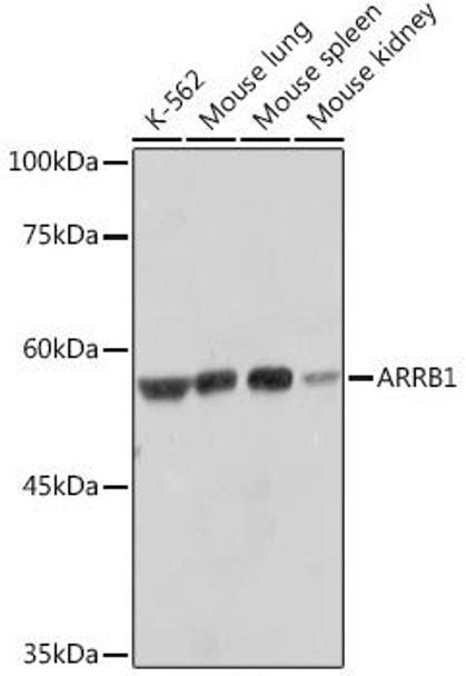 Anti-ARRB1 Antibody (CAB10742)