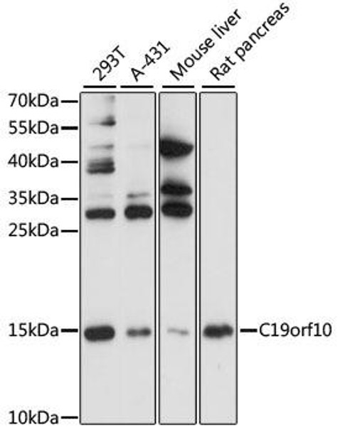 Anti-C19orf10 Antibody (CAB1093)