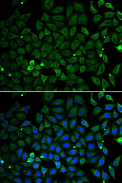 Anti-Parkin Antibody (CAB11172)