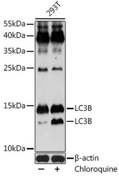 Anti-LC3B Antibody (CAB11280)
