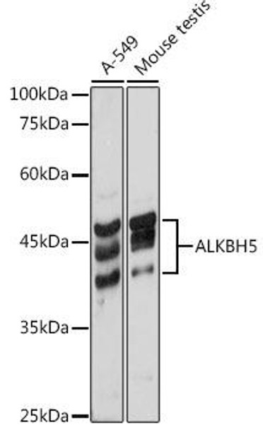 Anti-ALKBH5 Antibody (CAB11684)