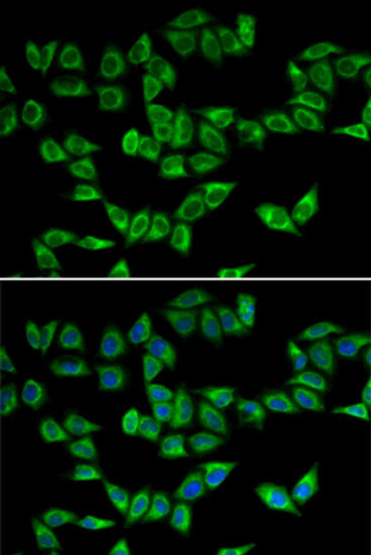 Anti-PRDX5 Antibody (CAB1269)