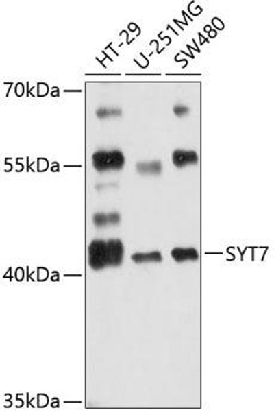 Anti-SYT7 Antibody (CAB12757)