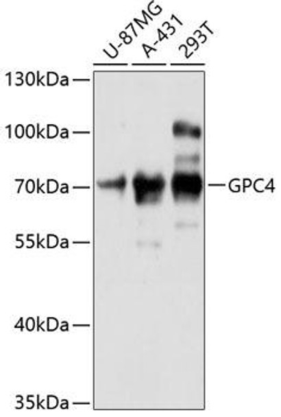 Anti-GPC4 Antibody (CAB12805)