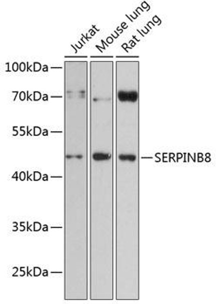Anti-SERPINB8 Antibody (CAB13039)