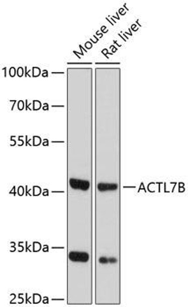 Anti-ACTL7B Antibody (CAB13146)