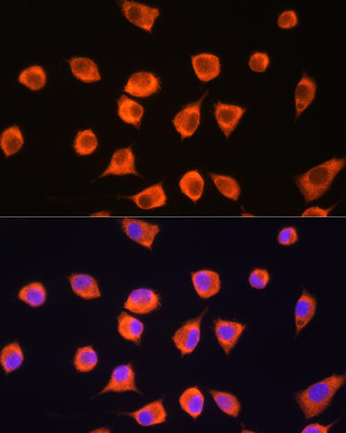 Anti-SCYL2 Antibody (CAB13178)