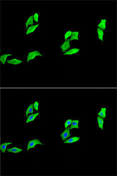 Anti-MB Antibody (CAB13326)