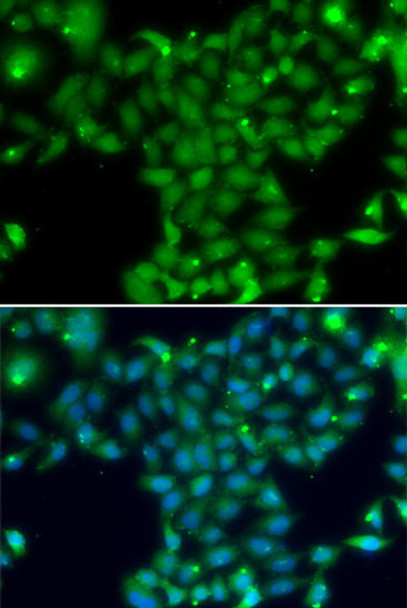 Anti-TGM5 Antibody (CAB13388)