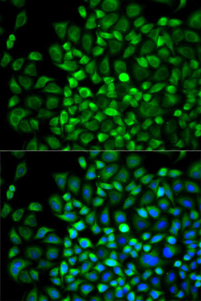 Anti-ANGPTL4 Antibody (CAB13425)