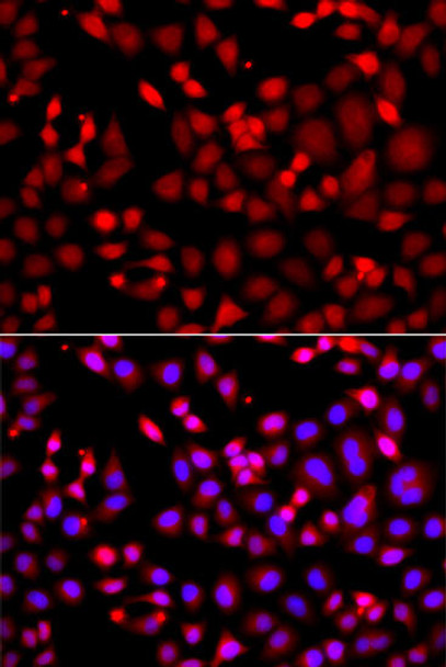 Anti-MTUS1 Antibody (CAB13437)