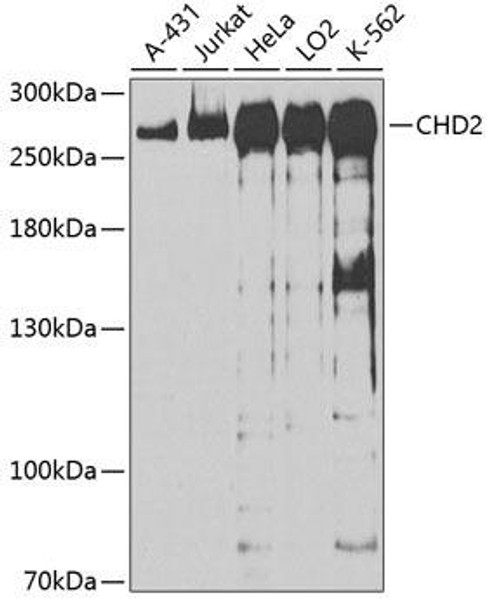 Anti-CHD2 Antibody (CAB13478)