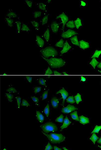 Anti-PSG1 Antibody (CAB13533)