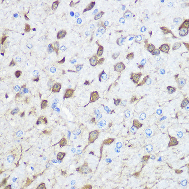Anti-PVALB Antibody (CAB13538)