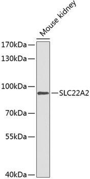 Anti-SLC22A2 Antibody (CAB14061) Anti-SLC22A2 Antibody (CAB14061)