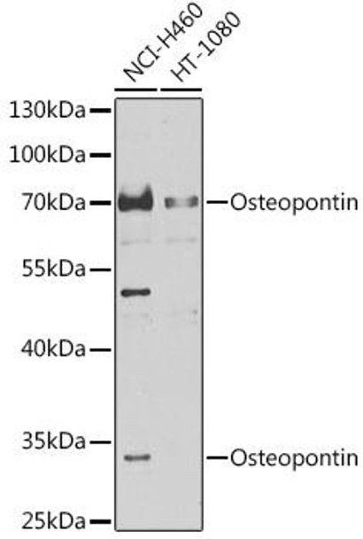 Anti-Osteopontin Antibody (CAB14062) Anti-Osteopontin Antibody (CAB14062)