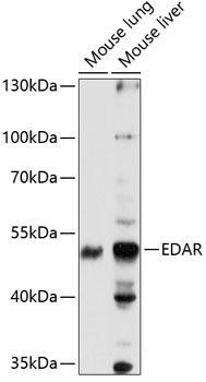 Anti-EDAR Antibody (CAB14105)
