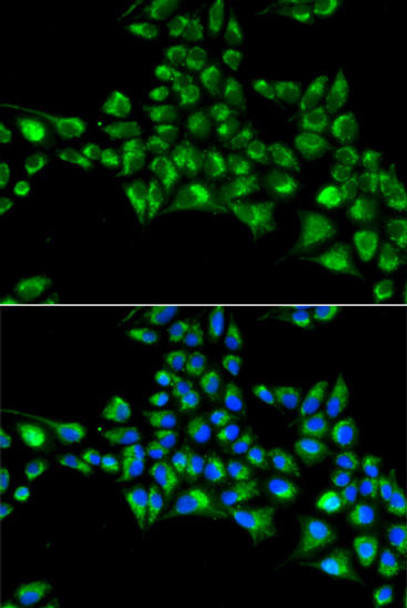 Anti-CYGB Antibody (CAB14155)