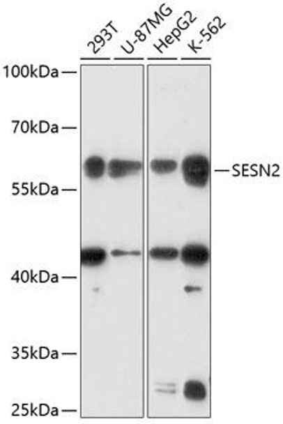 Anti-SESN2 Antibody (CAB14220)