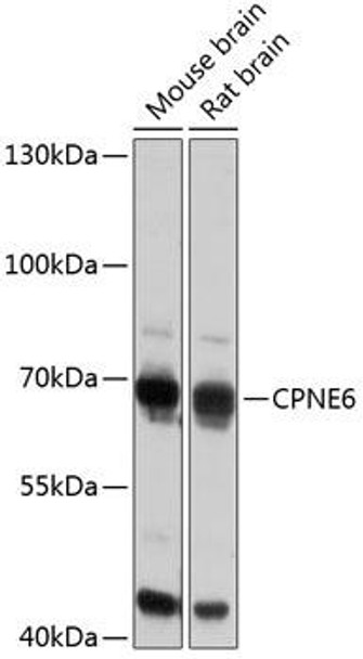Anti-CPNE6 Antibody (CAB14385)
