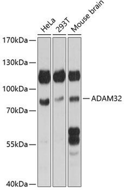 Anti-ADAM32 Antibody (CAB14977)
