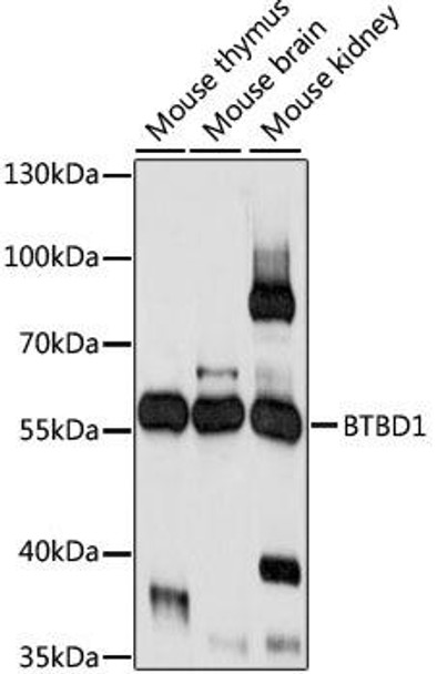 Anti-BTBD1 Antibody (CAB15161)