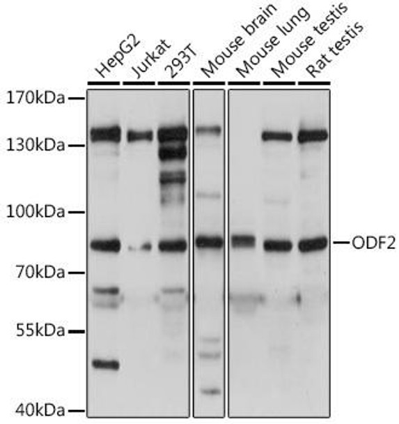 Anti-ODF2 Antibody (CAB15630)