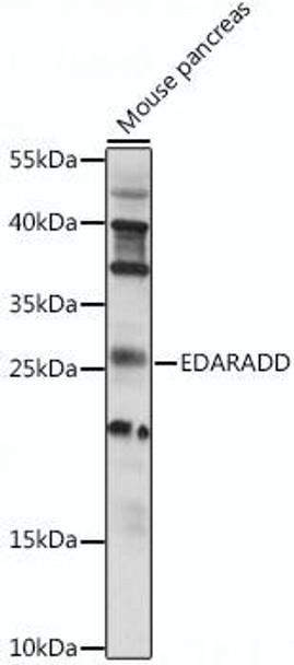 Anti-EDARADD Antibody (CAB15951)