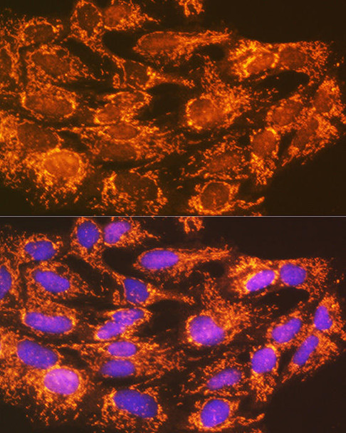 Anti-ACSL1 Antibody (CAB16253)