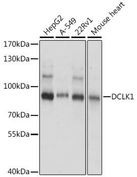 Anti-DCLK1 Antibody (CAB16464)
