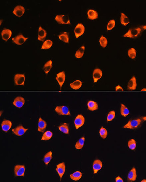 Anti-KIF21A Antibody (CAB16548)