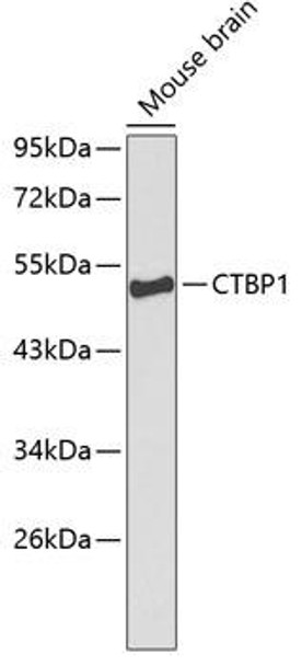 Anti-CTBP1 Antibody (CAB1707)