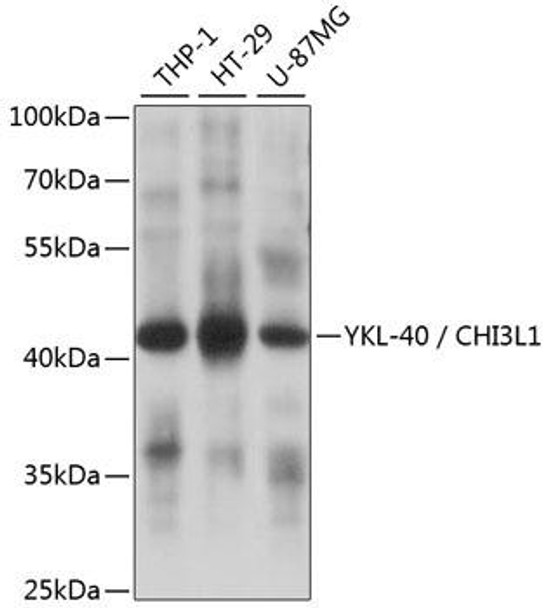 Anti-YKL-40 / CHI3L1 Antibody (CAB1723) Anti-YKL-40 / CHI3L1 Antibody (CAB1723)