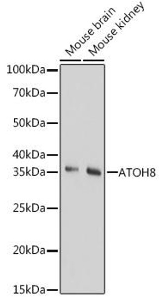 Anti-ATOH8 Antibody (CAB17232)