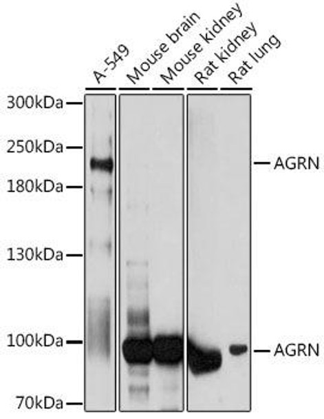 Anti-AGRN Antibody (CAB17320)