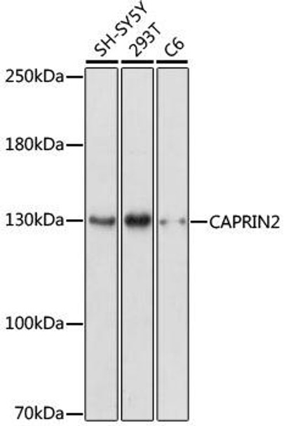 Anti-CAPRIN2 Antibody (CAB17365)