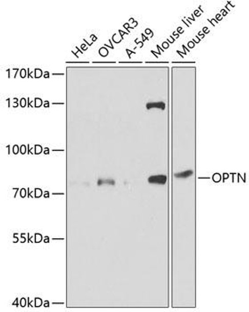 Anti-OPTN Antibody (CAB1845)