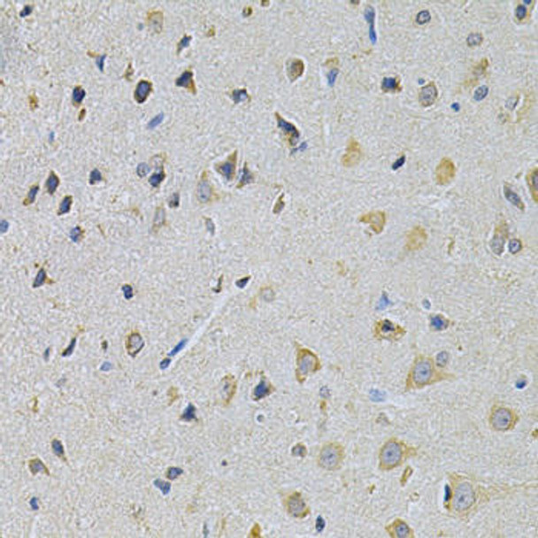 Anti-PPA1 Antibody (CAB2108)