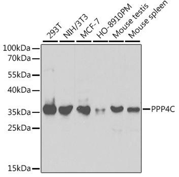 Anti-PPP4C Antibody (CAB2109)