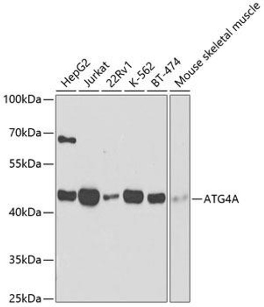 Anti-ATG4A Antibody (CAB2598)