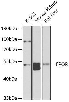Anti-EPOR Antibody (CAB2917)